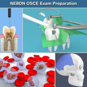 NEBDN Online OSCE Exam Revision and Preparation Dental Nurses by Dental Tutors Mock Exams